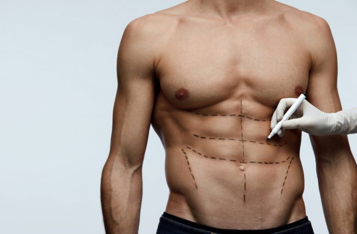 plastic-surgery-toned-appearance-six-pack-abs-shut